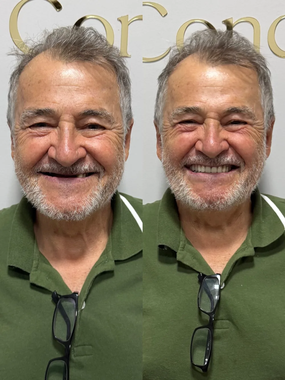 Paciente da Odonto Concept sorrindo depois do tratamento com implantes