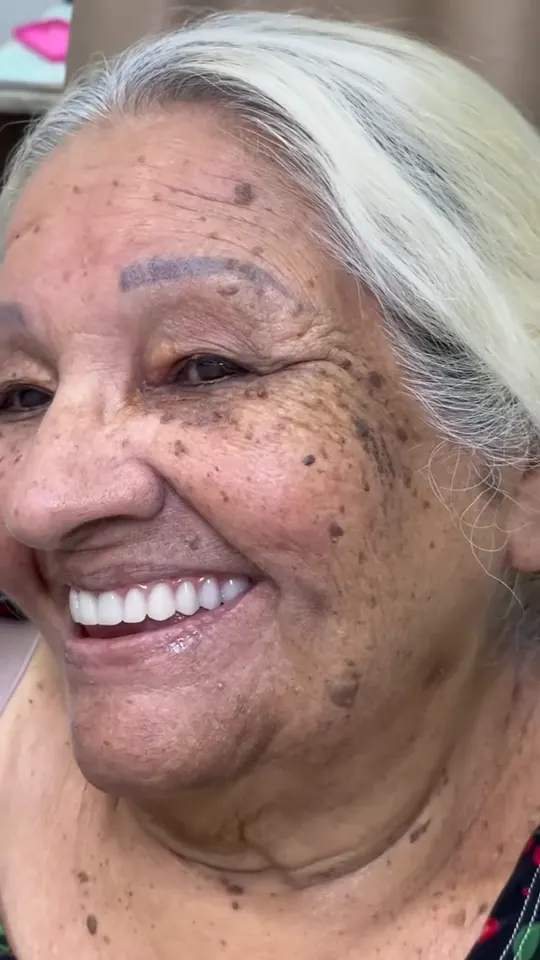 Paciente da Odonto Concept sorrindo depois da reabilitação do sorriso